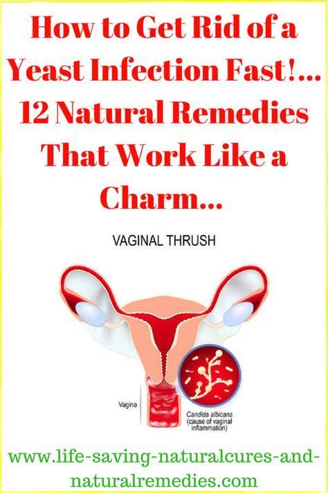 Powerful Yeast Infection Cure — Here’s A Natural Treatment For Vaginal