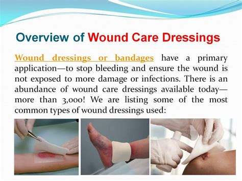 acquainted   types  wound dressings powerpoint  id