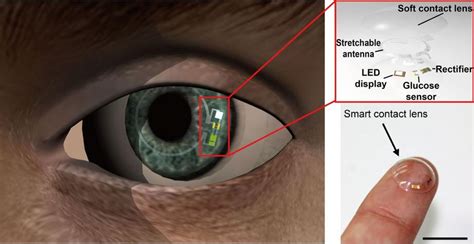 smart contact lenses could screen for pre diabetes and monitor glucose