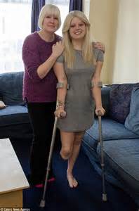 Portsmouth Woman Has Her Leg Amputated After Doctors Fail