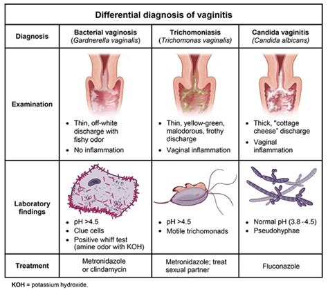 Enhancement Pills Male Enhancement Np School Bacterial Vaginosis
