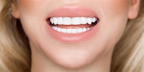 living with porcelain veneers dos and don ts cosmetic
