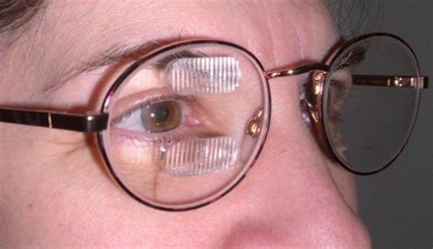 Prism Glasses Expand The View For Patients With Hemianopia Vision