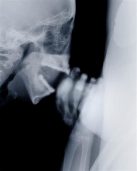 x ray sex black boob pics