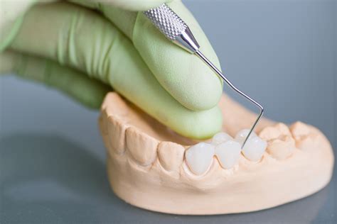differents types de protheses dentaires clinique dentaire charles trottier