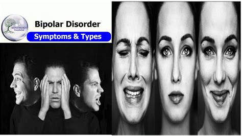 bipolar disorder symptomstypes treatment