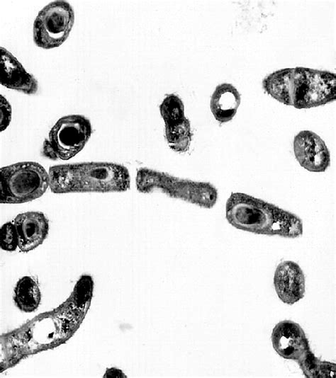 picture transmission electron micrograph bacillus anthracis