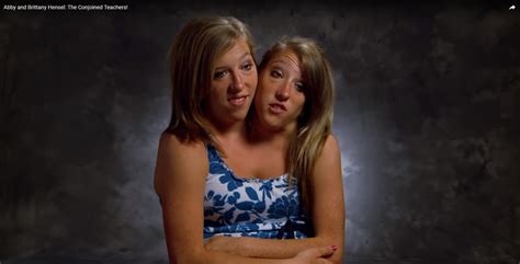 What Famous Conjoined Twins Abby And Brittany Hensel Are