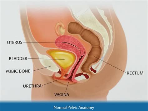 Pelvic Organ Prolapse Riachi Surgery Dr Labib Riachi