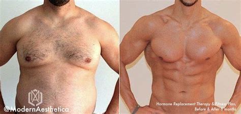 hormone optimization therapy for men schedule a