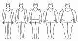 Body Vector Mass Obesity Underweight Obese Fat Illustration Index Weight Male Man Extremely Different Contours Degrees Woman Human Vecteezy Silhouettes sketch template