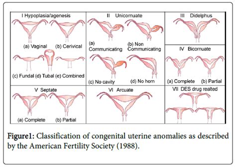 sexual disorders congenital uterine anomalies