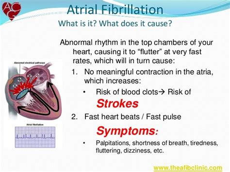 What Is Atrial Fibrillation Afib