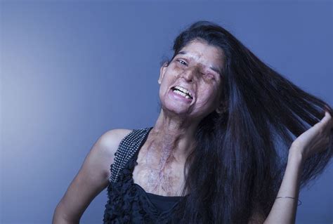 acid attack victims  ground breaking photo shoot cnn