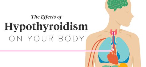 Effects Of Hypothyroidism Thinning Hair Heart Attack And More