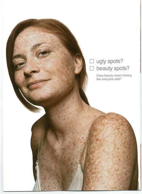 Freckles Fabulous A Campaign For Real Beauty Oh No She Didn’t