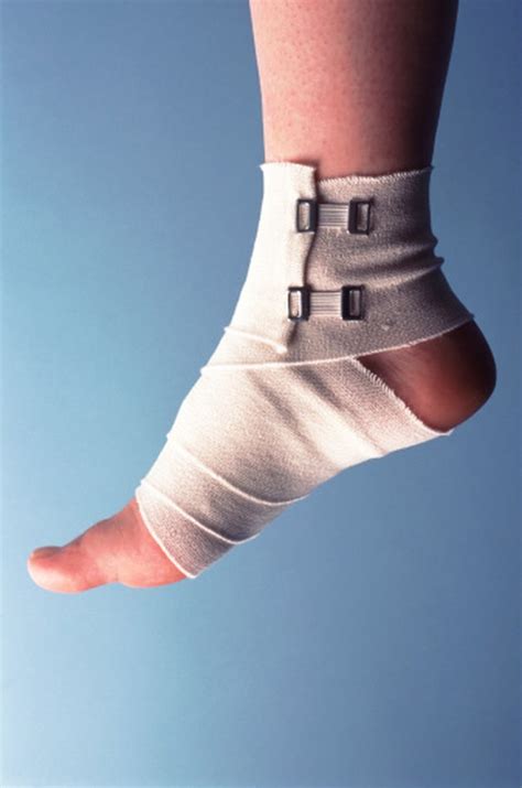 care   sprained foot livestrongcom