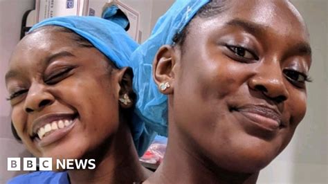 conjoined twins we always knew we were different bbc news