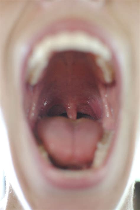 the world s best photos of mouth and uvula flickr hive mind