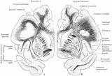 Coronal Cerebral Sections Hemispheres Clipart Etc Tiff Usf Edu Large sketch template