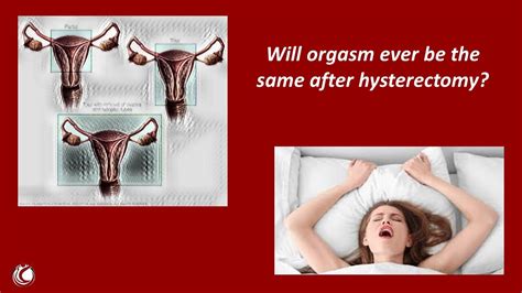 will orgasm ever be the same after hysterectomy for