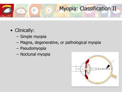 ppt myopia powerpoint presentation free download id 5459221