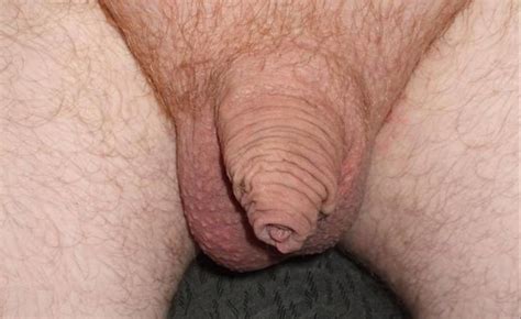 soft and small uncut cocks 301 pics 2 xhamster