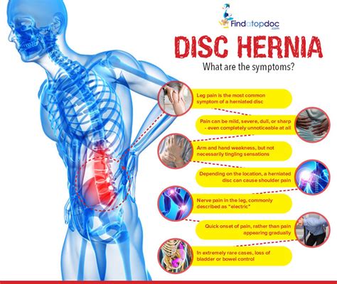 prolapsed herniated disc