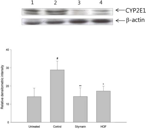 Western Blot Analysis Of Cyp2e1 Levels In Rat Liver The Expression