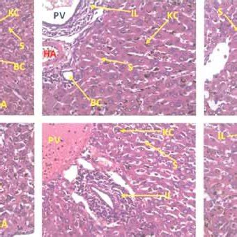 photomicrographs   liver  giemsa stain  negative  scientific diagram