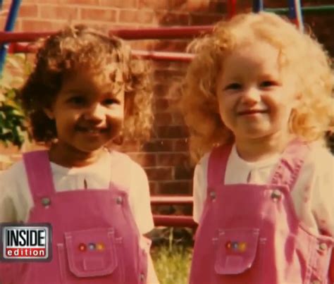 world s only biracial twins are now grown up daily spikes