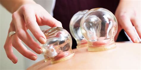 What Is Cupping Therapy Benefits Of Cupping Massage