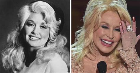 dolly parton s plastic surgery transformation now to love