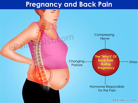 Pregnancy And Back Pain The “why’s” And The Remedies