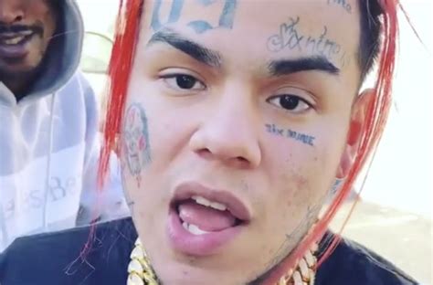6ix9ine before and after teeth verzameling