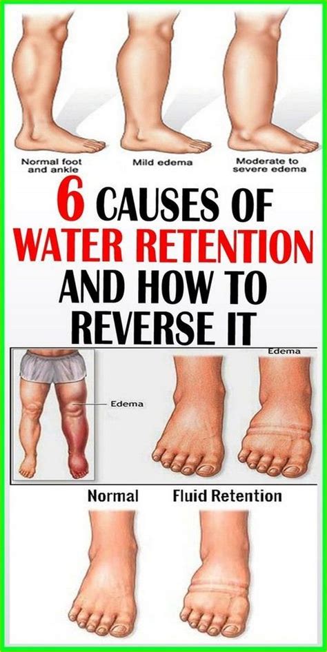 Pin By Tailored For You Properties On Beauty Hacks Water Retention