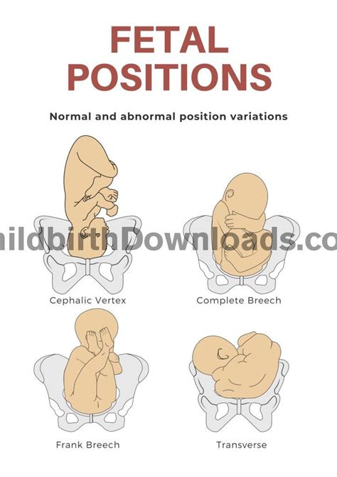 Fetal Positions Digital Poster Available To Download And Print Ideal