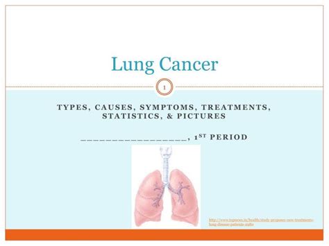 Ppt Lung Cancer Powerpoint Presentation Free Download Id 2820460
