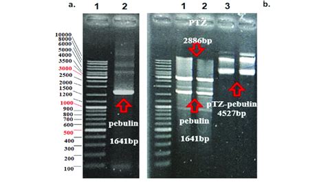A Pcr Product Of Pebulin Gene Lane 1 Generuler 1 Kb Dna Ladder