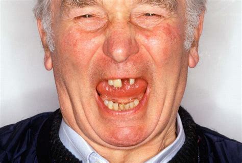 reasons   people  lose  teeth dental blog