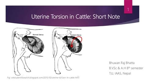 uterine torsion