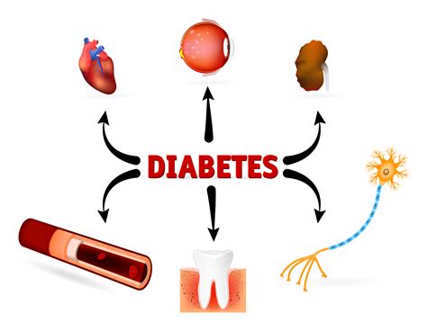 complexities  diabetes treatment type  type     pcsk