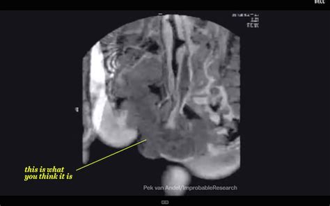 Mri View Of What Really Goes On Inside Your Body When You Re Having Sex