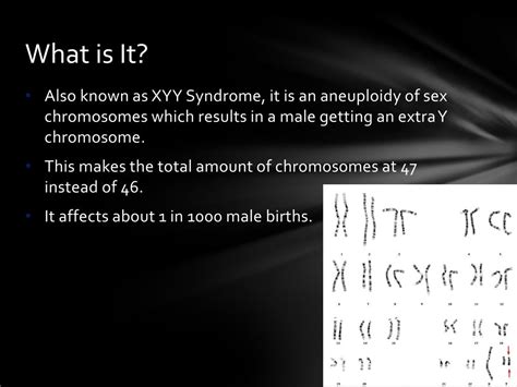 ppt extra y super male syndrome powerpoint