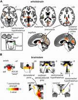 Rvlm Fmri Coupled Frontiersin Identifying Increases Msna Fluctuations Fnins sketch template
