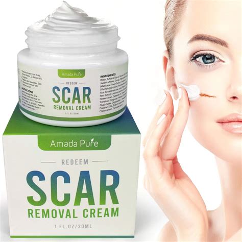 scar cream buyers guide  reviewthis