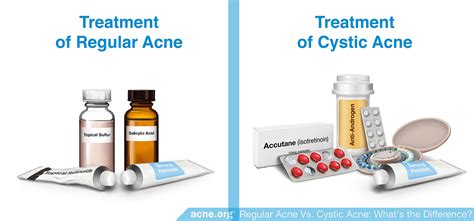 Regular Acne Vs Cystic Acne What S The Difference