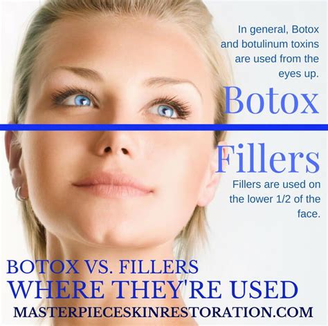 botox  fillers   work     infographic