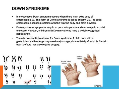 Ppt Mutations And Genetic Diseases Powerpoint
