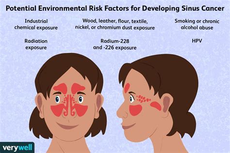 sinus cancer   risk factors